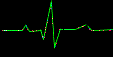 wavechart.gif - 1776 Bytes